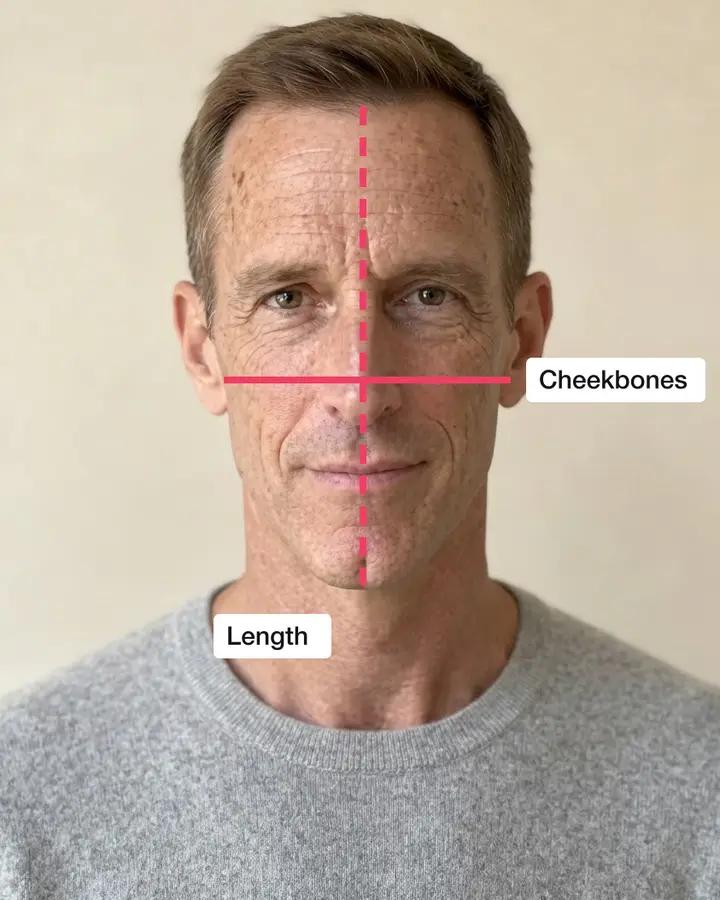A man with a long face, a line across his cheekbones and one from hairline to chin