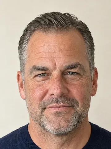 A man with a receding hairline, early stage