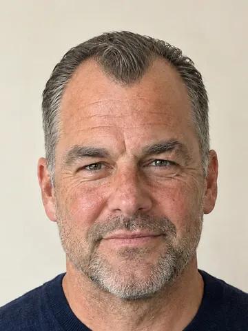 A man with a receding hairline, clear m stage